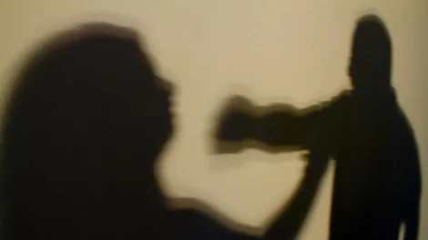 Mulher é agredida com socos no rosto ao flagrar ex em momento íntimo no PR